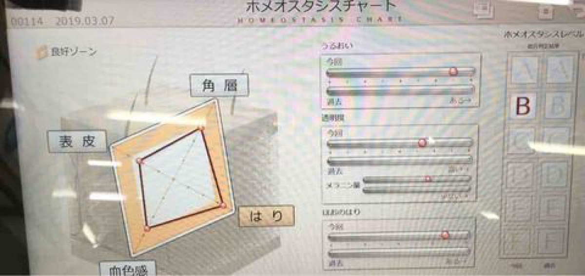 一年前より透明感がある肌に。肌測定・お稽古・エステ